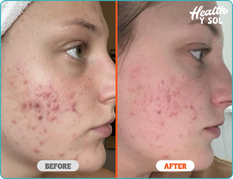 Before & After