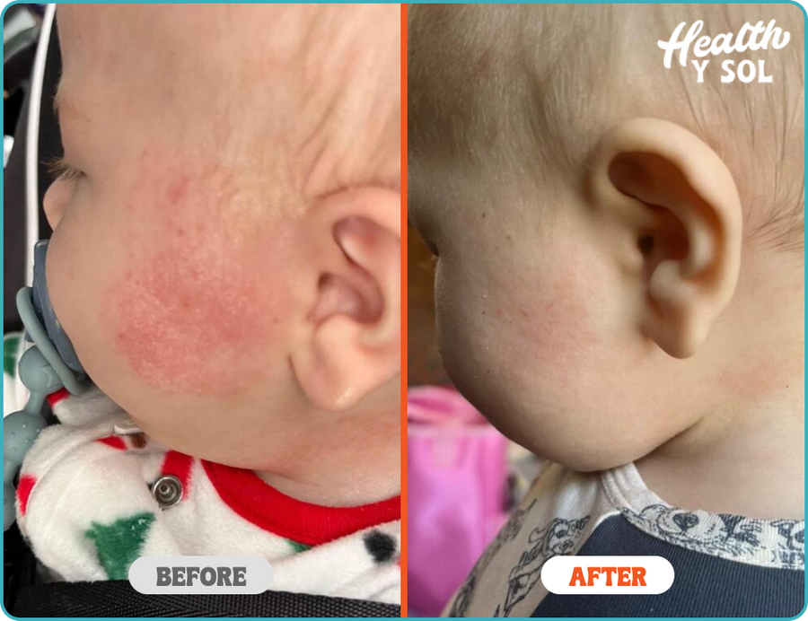 Before & After