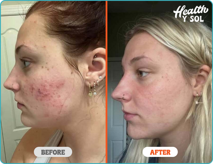 Before & After