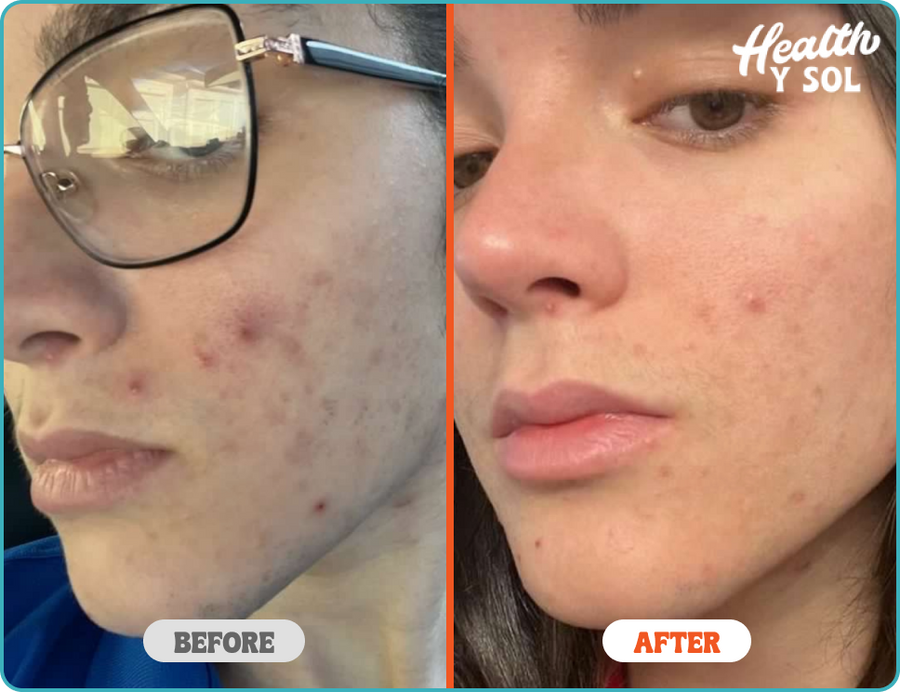 Before & After